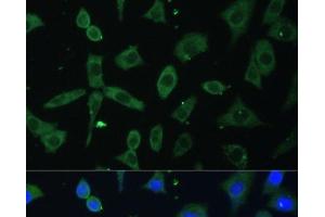 Immunofluorescence analysis of L-929 cells using EIF3D Polyclonal Antibody at dilution of 1:100. (EIF3D antibody)