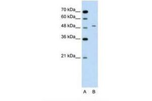 Image no. 2 for anti-Alanine Aminotransferase (ALT) (AA 81-130) antibody (ABIN320979)