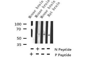 Western blot analysis of Phospho-Tyrosine Hydroxylase (Ser19) expression in various lysates (Tyrosine Hydroxylase antibody  (pSer19))