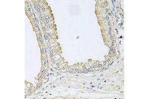 Immunohistochemistry of paraffin-embedded human prostate using ANKH antibody (ABIN6003613) at dilution of 1/100 (40x lens).