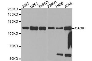 Western Blotting (WB) image for anti-Calcium/calmodulin-Dependent serine Protein Kinase (MAGUK Family) (CASK) antibody (ABIN1871447) (CASK antibody)