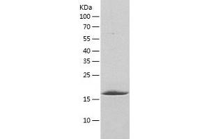 Western Blotting (WB) image for Gastrin-Releasing Peptide (GRP) (AA 1-172) protein (His tag) (ABIN7287430) (Gastrin-Releasing Peptide Protein (GRP) (AA 1-172) (His tag))