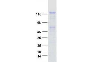 Western Blotting (WB) image for Fibroblast Growth Factor Receptor 1 (FGFR1) (Transcript Variant 1) protein (Myc-DYKDDDDK Tag) (ABIN2721112)