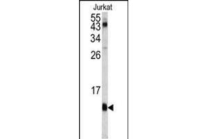 Western blot analysis of FKBP1A antibody (C-term) (ABIN1882082 and ABIN2841885) in Jurkat cell line lysates (35 μg/lane).