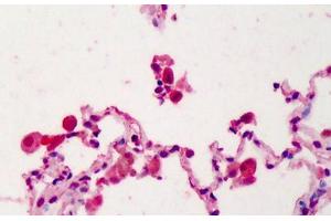 Human Lung: Formalin-Fixed, Paraffin-Embedded (FFPE) (IL22 Receptor alpha 1 antibody  (N-Term))