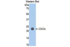 Western Blotting (WB) image for anti-Interleukin 13 Receptor, alpha 1 (IL13RA1) (AA 201-360) antibody (ABIN3206304) (IL13 Receptor alpha 1 antibody  (AA 201-360))