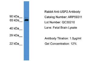 WB Suggested Anti-USP2  Antibody Titration: 0. (USP2 antibody  (Middle Region))