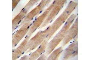 RHEB antibody immunohistochemistry analysis in formalin fixed and paraffin embedded human skeletal muscle. (RHEB antibody  (AA 104-134))
