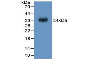 Detection of Recombinant F13A1, Rat using Polyclonal Antibody to Coagulation Factor XIII A1 Polypeptide (F13A1) (F13A1 antibody  (AA 140-377))