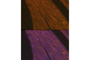 Immunofluorescence (IF) image for anti-Cardiac Troponin T (cTnT) (AA 1-120) antibody (ABIN3021486)
