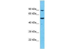 Western Blotting (WB) image for anti-Meiosis Specific with OB Domains (MEIOB) (C-Term) antibody (ABIN2786254) (MEIOB antibody  (C-Term))