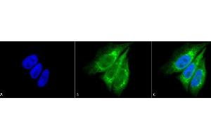 Immunocytochemistry/Immunofluorescence analysis using Rabbit Anti-KDEL Polyclonal Antibody (ABIN863187 and ABIN863188). (KDEL antibody)
