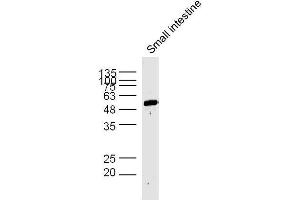 Mouse small intestine lysates probed with AP1M2 Polyclonal Antibody, unconjugated  at 1:300 overnight at 4°C followed by a conjugated secondary antibody at 1:10000 for 60 minutes at 37°C. (AP1m2 antibody  (AA 1-100))