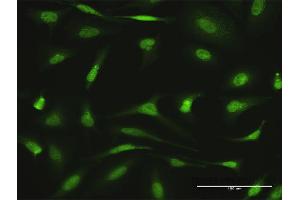 Immunofluorescence of purified MaxPab antibody to AGGF1 on HeLa cell.