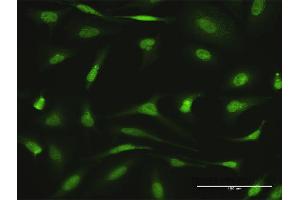 Immunofluorescence of purified MaxPab antibody to AGGF1 on HeLa cell. (AGGF1 antibody  (AA 1-714))