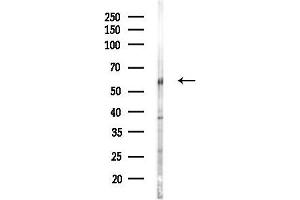 anti-Sestrin 3 (SESN3) (Internal Region) antibody