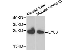 Western blot analysis of extracts of mouse liver and mouse stomach, using LY86 antibody.