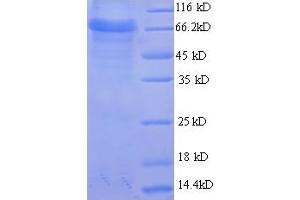 SDS-PAGE (SDS) image for Glucuronic Acid Epimerase (GLCE) (AA 29-617) protein (His tag) (ABIN5709583)