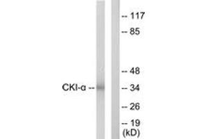 Western blot analysis of extracts from HeLa cells, using CKI-alpha Antibody. (CSNK1A1 antibody  (AA 126-175))