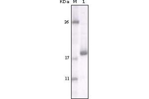 Western Blotting (WB) image for anti-Discoidin Domain Receptor tyrosine Kinase 2 (DDR2) (truncated) antibody (ABIN2464044) (DDR2 antibody  (truncated))