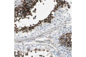 Immunohistochemical staining (Formalin-fixed paraffin-embedded sections) of human testis with SLC2A3 polyclonal antibody  shows strong cytoplasmic positivity in cells in seminiferous ducts at 1:200-1:500 dilution. (SLC2A3 antibody)