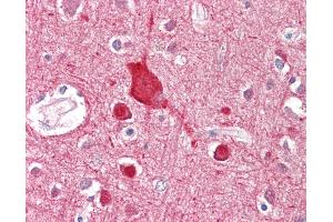 Anti-ABCA2 antibody IHC staining of human brain, cortex. (ABCA2 antibody  (AA 2363-2376))
