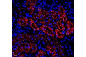 Immunofluorescence (Paraffin-embedded Sections) (IF (p)) image for anti-Retinol Binding Protein 4, Plasma (RBP4) antibody (ABIN7075409)