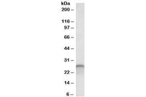 Western blot testing of human cerebellum lysate with Calbindin 1 antibody at 0. (CALB1 antibody)