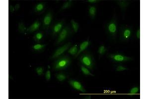 Immunofluorescence of monoclonal antibody to NEK10 on HeLa cell.