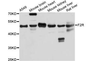 Western blot analysis of extracts of various cell lines, using F2R antibody (ABIN5974987) at 1/1000 dilution. (PAR1 antibody)