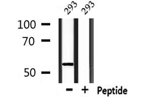 Western blot analysis of extracts from 293, using KRT12 Antibody.