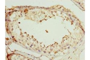 Immunohistochemistry of paraffin-embedded human testis tissue using ABIN7168517 at dilution of 1:100 (SCAPER antibody  (AA 1109-1400))