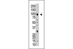 The USP5 polyclonal antibody  is used in Western blot to detect USP5 in HL-60 cell lysate . (USP5 antibody  (AA 59-90))