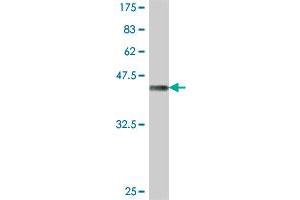 Western Blot detection against Immunogen (38. (CTHRC1 antibody  (AA 32-141))
