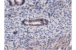 Image no. 9 for anti-Acyl-CoA Thioesterase 12 (ACOT12) antibody (ABIN1496414) (ACOT12 antibody)