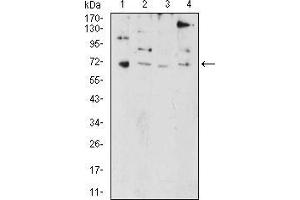 Western Blotting (WB) image for anti-PR Domain Containing 5 (PRDM5) (AA 1-100) antibody (ABIN5874500) (PRDM5 antibody  (AA 1-100))