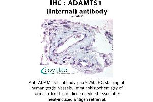 Image no. 1 for anti-ADAM Metallopeptidase with Thrombospondin Type 1 Motif, 1 (ADAMTS1) (Internal Region) antibody (ABIN1731523) (ADAMTS1 antibody  (Internal Region))