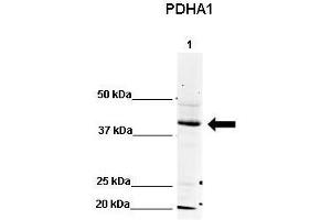 WB Suggested Anti-PDHA1 Antibody    Positive Control:  Lane 1: 80ug mouse brain extract   Primary Antibody Dilution :   1:500  Secondary Antibody :  IRDye 800 CW goat anti-rabbit from Li-COR Bioscience  Secondry Antibody Dilution :   1:20,000  Submitted by:  Dr. (PDHA1 antibody  (N-Term))