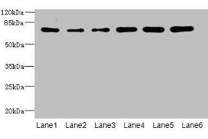 Western blot All lanes: ZNF555 antibody at 2 μg/mL Lane 1: HepG2 whole cell lysate Lane 2: 293T whole cell lysate Lane 3: Hela whole cell lysate Lane 4: Jurkat whole cell lysate Lane 5: Mouse liver tissue Lane 6: HL60 whole cell lysate Secondary Goat polyclonal to rabbit IgG at 1/10000 dilution Predicted band size: 74, 64, 73 kDa Observed band size: 74 kDa (ZNF555 antibody  (AA 1-200))