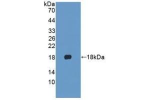 Detection of Recombinant KRT1, Human using Polyclonal Antibody to Cytokeratin 1 (CK1) (Cytokeratin 1 antibody  (AA 487-644))
