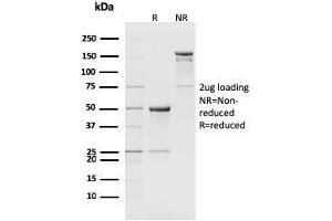 SDS-PAGE Analysis Purified CD8b Rat Monoclonal Antibody (H35-17.
