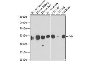 Western blot analysis of extracts of various cell lines using IHH Polyclonal Antibody at dilution of 1:1000. (Indian Hedgehog antibody)