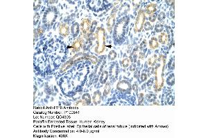 Human kidney (IRF8 antibody  (N-Term))