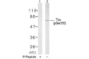 Image no. 1 for anti-Microtubule-Associated Protein tau (MAPT) (pSer235) antibody (ABIN196798) (MAPT antibody  (pSer235))