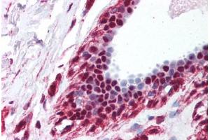 Human Breast (formalin-fixed, paraffin-embedded) stained with BAT1 antibody ABIN214087 at 5 ug/ml followed by biotinylated goat anti-rabbit IgG secondary antibody ABIN481713, alkaline phosphatase-streptavidin and chromogen. (DDX39B antibody  (C-Term))