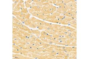 Immunohistochemistry of paraffin embedded mouse heart using Junctophilin2 (ABIN7074393) at dilution of 1: 600 (400x lens) (Junctophilin 2 antibody)
