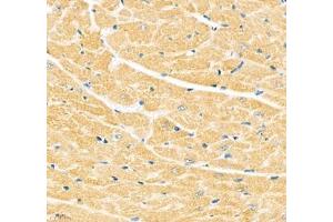 Immunohistochemistry of paraffin embedded mouse heart using Junctophilin2 (ABIN7074393) at dilution of 1: 600 (400x lens) (Junctophilin 2 antibody)