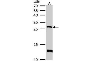 WB Image HPRT antibody detects HPRT1 protein by Western blot analysis.