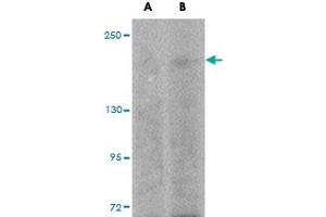 Western blot analysis of SIPA1L1 in rat brain tissue lysate with SIPA1L1 polyclonal antibody  at (A) 0. (SIPA1L1 antibody  (N-Term))