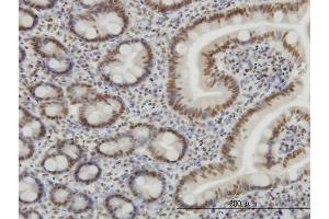 Immunoperoxidase of monoclonal antibody to SP1 on formalin-fixed paraffin-embedded human small Intestine. (SP1 antibody  (AA 89-198))